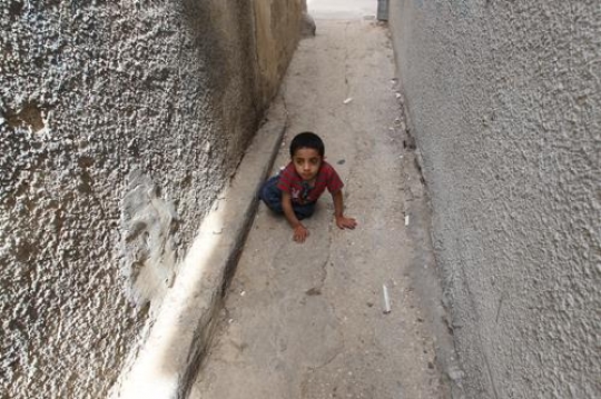 disabled little boy